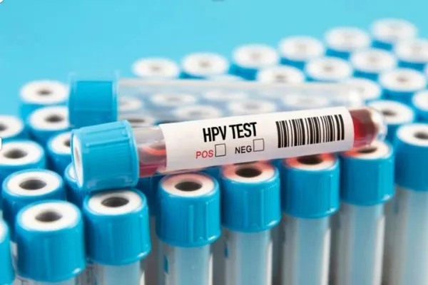 HPV 56 pozitif ne demek? Kanser miyim? - Antalya